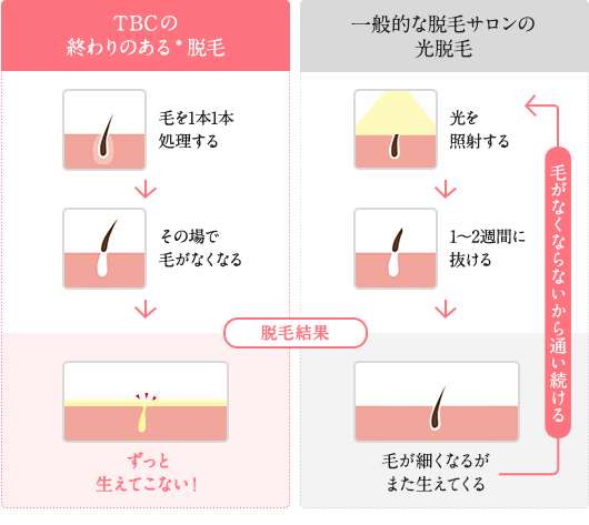 なぜ生えてこないのか？スーパー脱毛の仕組み